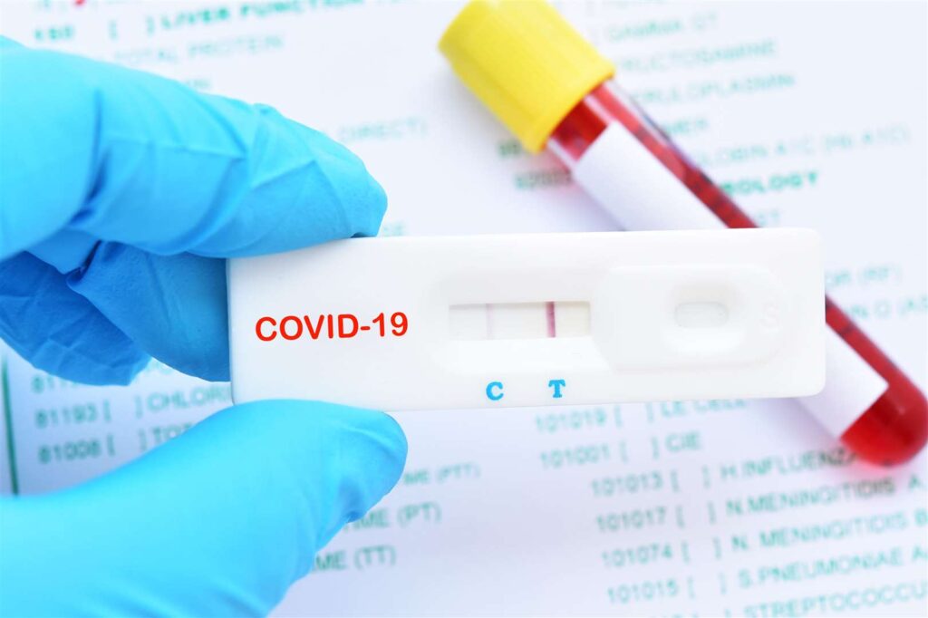 Covid Test Results