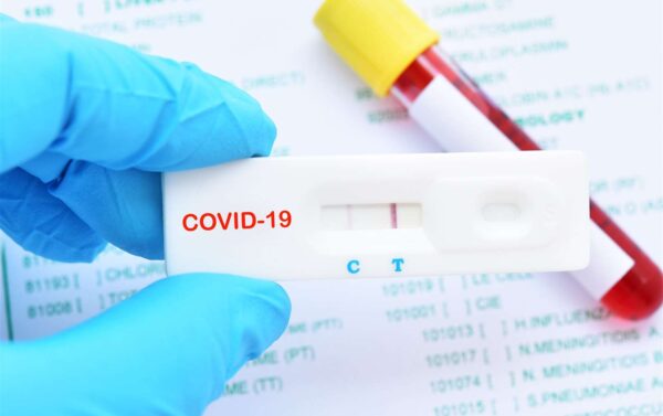 Covid Test Results